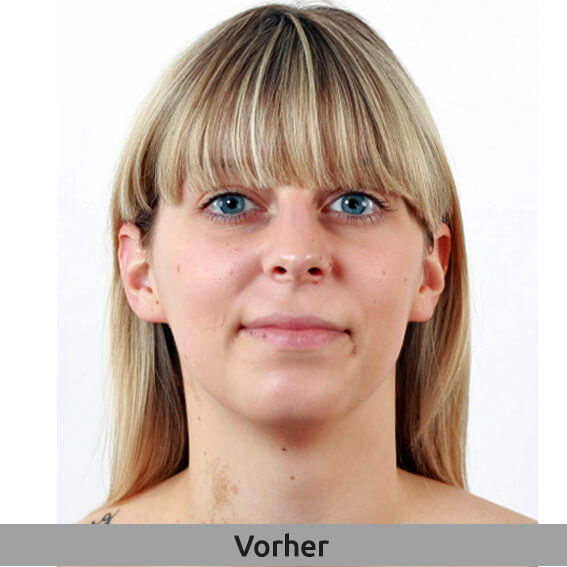 Vorher- / Nachher-Foto
